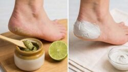 Quick Healing Method for Dry Cracked Heels Using Simple Kitchen Ingredients That Actually Work